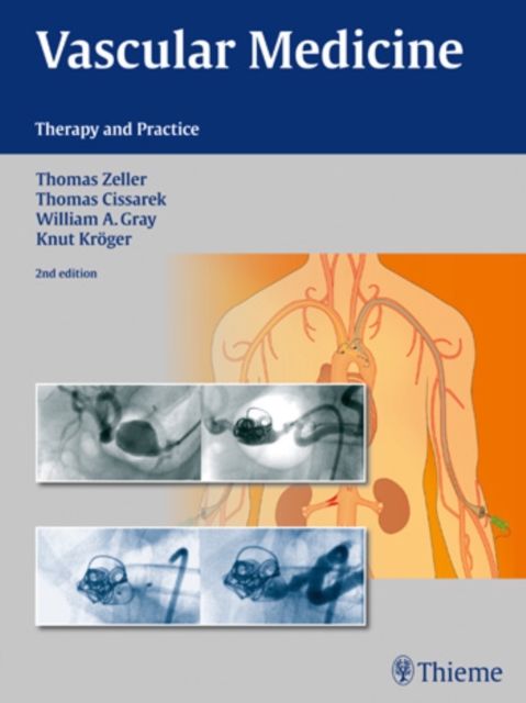 Vascular Medicine : Therapy and Practice, Hardback Book