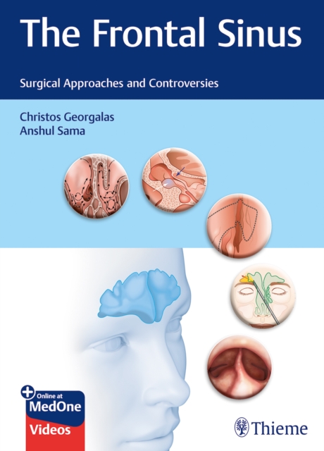The Frontal Sinus : Surgical Approaches and Controversies, Multiple-component retail product, part(s) enclose Book