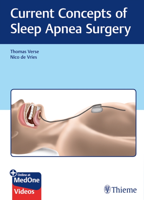 Current Concepts of Sleep Apnea Surgery, Multiple-component retail product, part(s) enclose Book