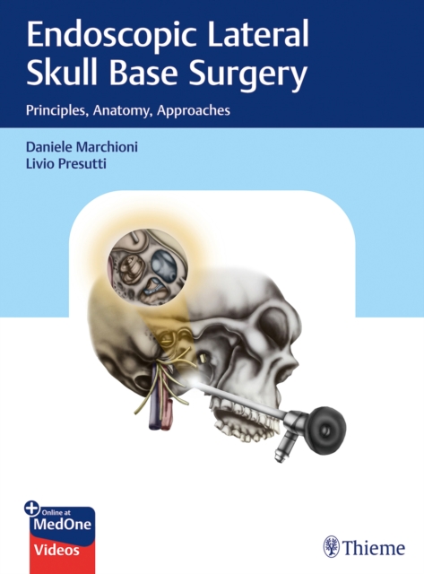 Endoscopic Lateral Skull Base Surgery : Principles, Anatomy, Approaches, Mixed media product Book