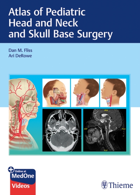 Atlas of Pediatric Head and Neck and Skull Base Surgery, Mixed media product Book