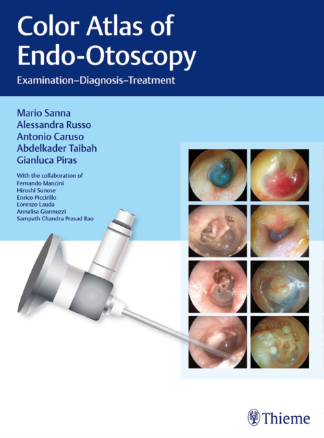 Color Atlas of Endo-Otoscopy : Examination - Diagnosis - Treatment, Hardback Book