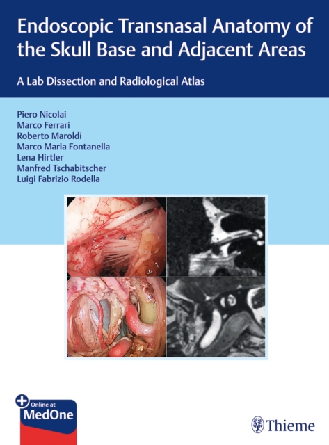Endoscopic Transnasal Anatomy of the Skull Base and Adjacent Areas : A Lab Dissection and Radiological Atlas, Multiple-component retail product, part(s) enclose Book