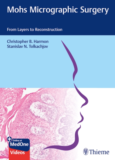 Mohs Micrographic Surgery: From Layers to Reconstruction, Mixed media product Book