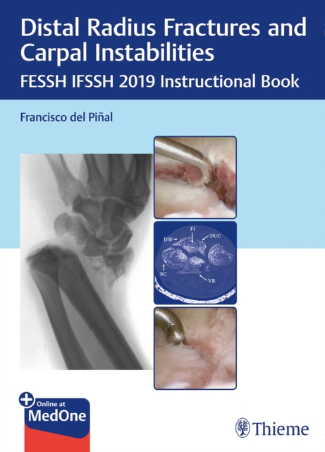 Distal Radius Fractures and Carpal Instabilities : FESSH IFSSH 2019 Instructional Book, Mixed media product Book