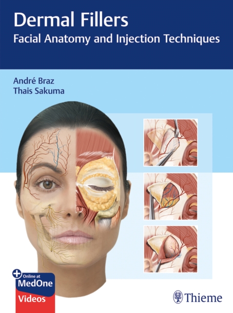 Dermal Fillers : Facial Anatomy and Injection Techniques, Multiple-component retail product, part(s) enclose Book