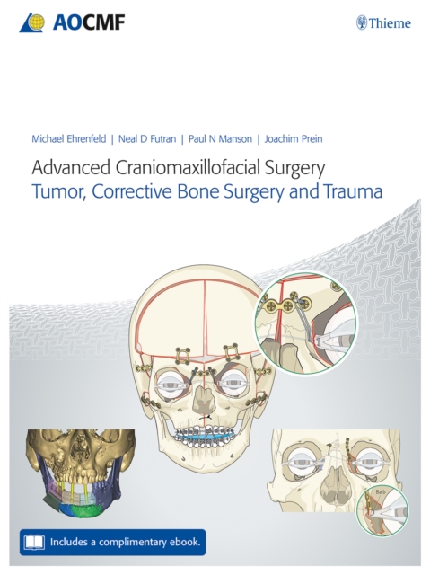 Advanced Craniomaxillofacial Surgery : Tumor, Corrective Bone Surgery, and Trauma, Mixed media product Book