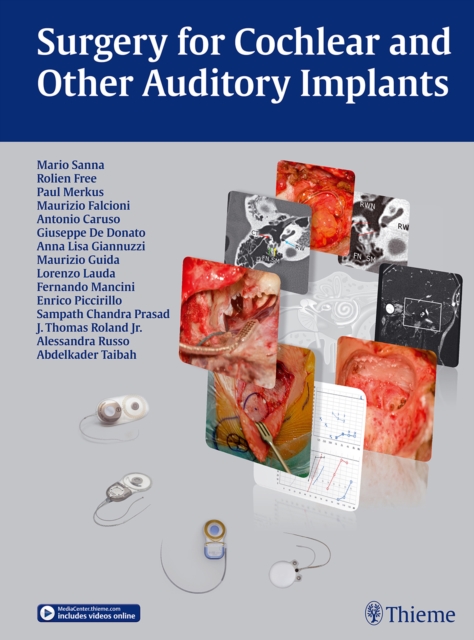 Surgery for Cochlear and Other Auditory Implants, Hardback Book