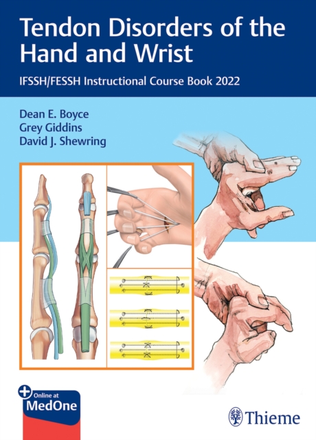 Tendon Disorders of the Hand and Wrist : IFSSH/FESSH Instructional Course Book 2022, Mixed media product Book