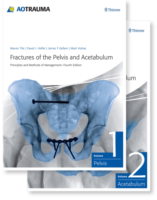 Fractures of the Pelvis and Acetabulum (AO) : Principles and Methods of Management, Multiple-component retail product, part(s) enclose Book