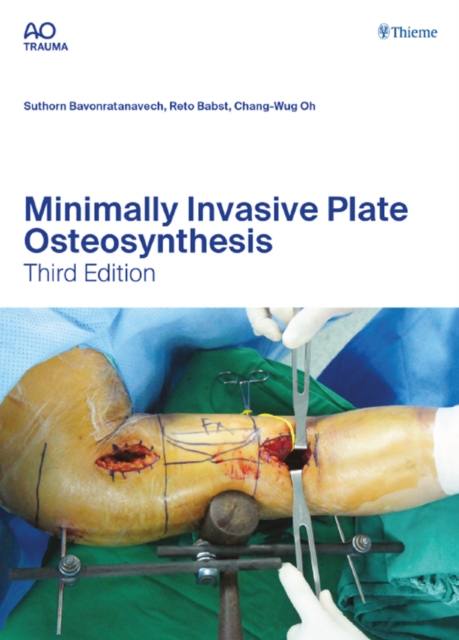 Minimally Invasive Plate Osteosynthesis, EPUB eBook