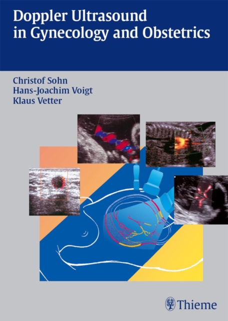 Doppler Ultrasound in Gynecology and Obstetrics, EPUB eBook