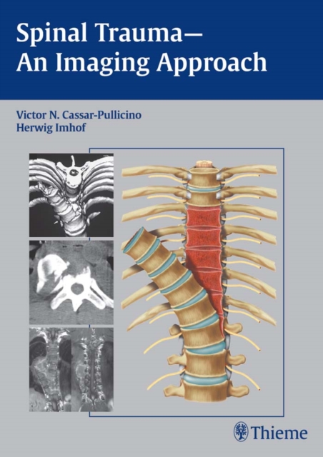 Spinal Trauma - An Imaging Approach, EPUB eBook