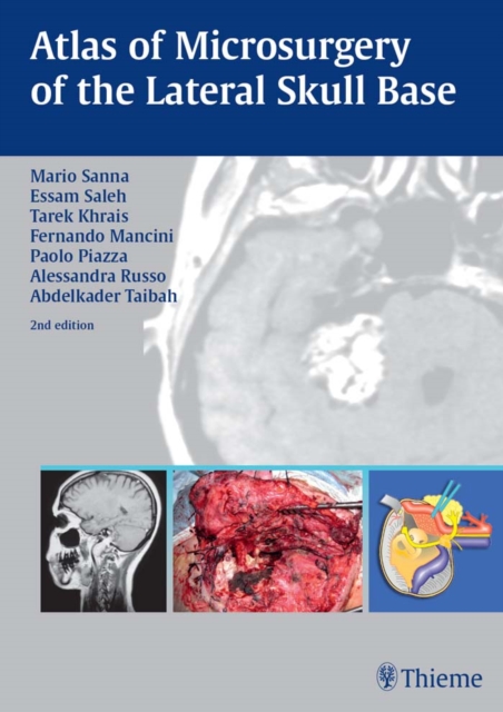 Atlas of Microsurgery of the Lateral Skull Base, EPUB eBook
