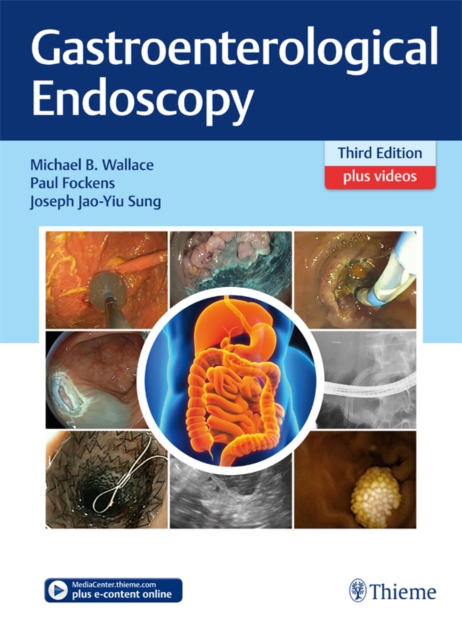 Gastroenterological Endoscopy, EPUB eBook