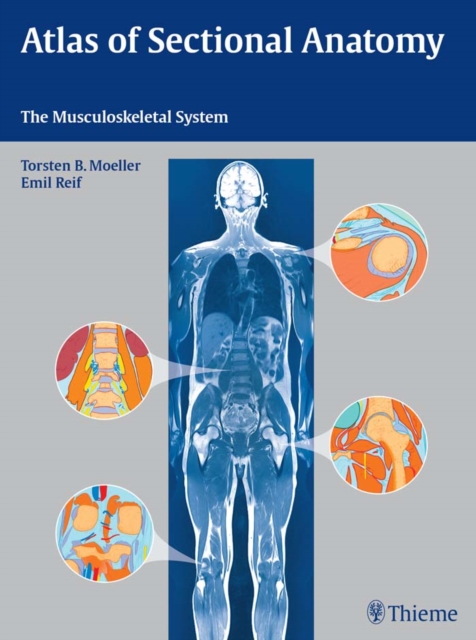 Atlas of Sectional Anatomy : The Musculoskeletal System, EPUB eBook