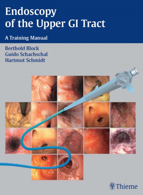 Endoscopy of the Upper GI Tract : A Training Manual, EPUB eBook