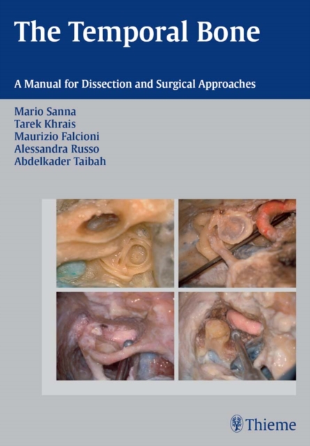 The Temporal Bone : A Manual for Dissection and Surgical Approaches, EPUB eBook