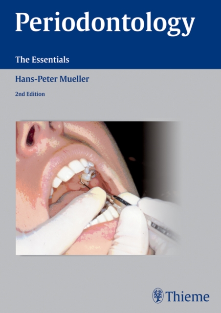 Periodontology : The Essentials, EPUB eBook