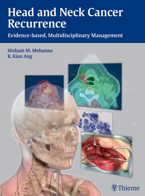 Head and Neck Cancer Recurrence : Evidence-based, Multidisciplinary Management, EPUB eBook
