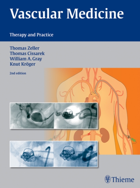 Vascular Medicine : Therapy and Practice, EPUB eBook