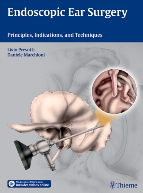 Endoscopic Ear Surgery : Principles, Indications, and Techniques, EPUB eBook
