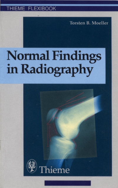 Normal Findings in Radiography, EPUB eBook