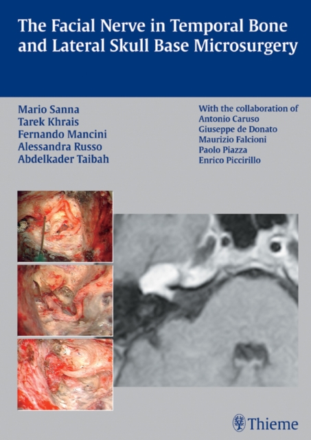 The Facial Nerve in Temporal Bone and Lateral Skull Base Microsurgery, EPUB eBook