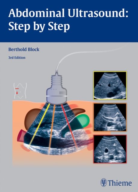 Abdominal Ultrasound: Step by Step, EPUB eBook