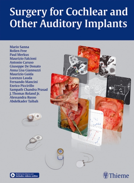 Surgery for Cochlear and Other Auditory Implants, EPUB eBook