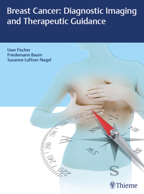 Breast Cancer: Diagnostic Imaging and Therapeutic Guidance, EPUB eBook