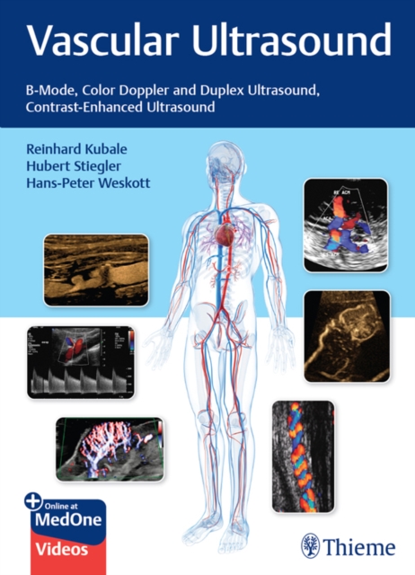 Vascular Ultrasound : B-Mode, Color Doppler and Duplex Ultrasound, Contrast-Enhanced Ultrasound, EPUB eBook