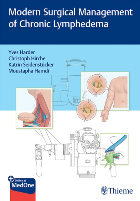 Modern Surgical Management of Chronic Lymphedema, EPUB eBook