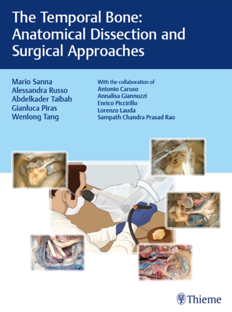 The Temporal Bone : Anatomical Dissection and Surgical Approaches, EPUB eBook