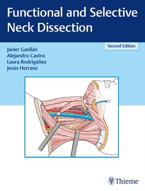 Functional and Selective Neck Dissection, EPUB eBook
