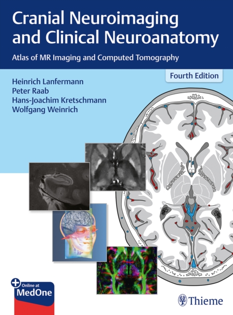 Cranial Neuroimaging and Clinical Neuroanatomy : Atlas of MR Imaging and Computed Tomography, Mixed media product Book