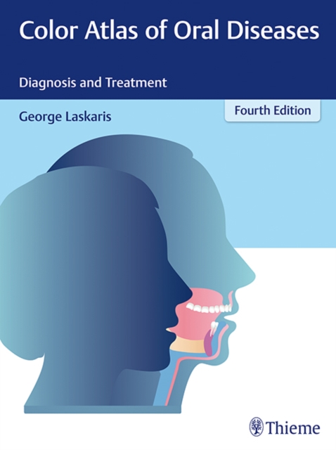 Color Atlas of Oral Diseases : Diagnosis and Treatment, Hardback Book