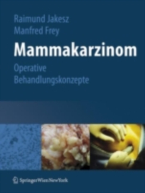Mammakarzinom : Operative Behandlungskonzepte, PDF eBook