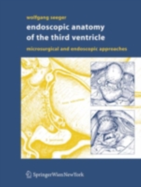 Endoscopic Anatomy of the Third Ventricle : Microsurgical and Endoscopic Approaches, PDF eBook