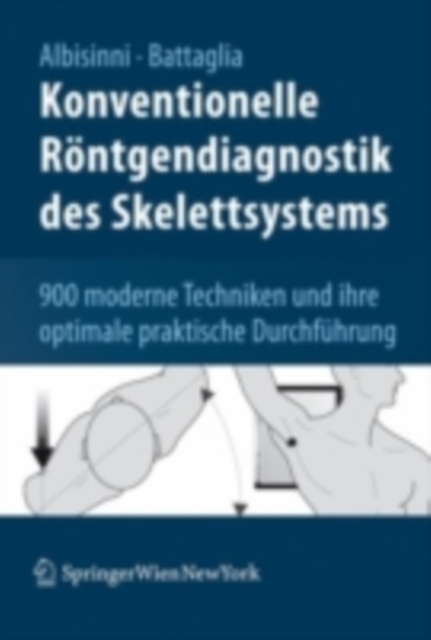 Konventionelle Rontgendiagnostik des Skelettsystems : 900 moderne Techniken und ihre optimale praktische Durchfuhrung, PDF eBook
