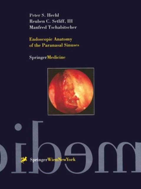 Endoscopic Anatomy of the Paranasal Sinuses, Hardback Book