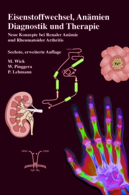 Eisenstoffwechsel, Anamien Therapie Und Diagnose, Paperback Book