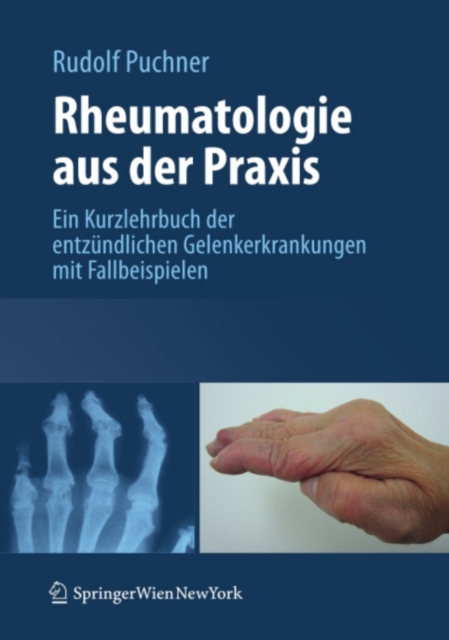 Rheumatologie aus der Praxis : Kurzlehrbuch der entzundlichen Gelenkerkrankungen mit Fallbeispielen, PDF eBook