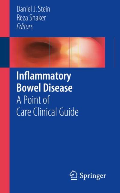 Inflammatory Bowel Disease : A Point of Care Clinical Guide, PDF eBook