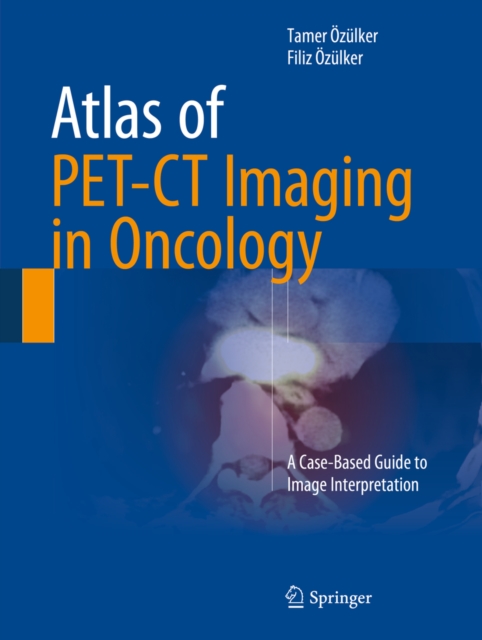 Atlas of PET-CT Imaging in Oncology : A Case-Based Guide to Image Interpretation, PDF eBook
