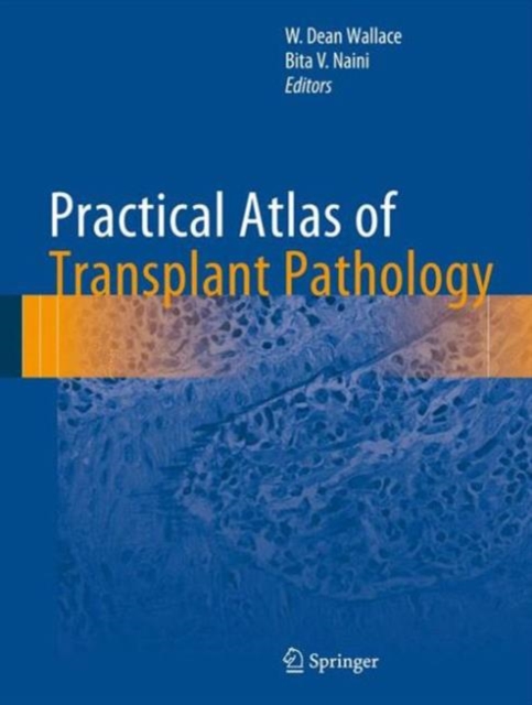 Practical Atlas of Transplant Pathology, Hardback Book