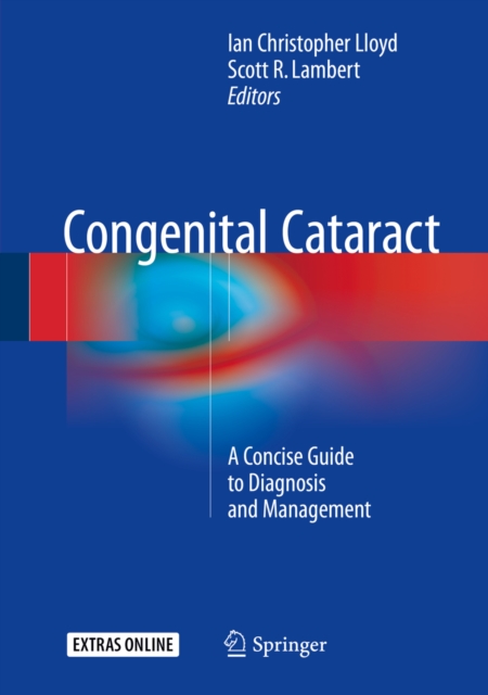Congenital Cataract : A Concise Guide to Diagnosis and Management, EPUB eBook