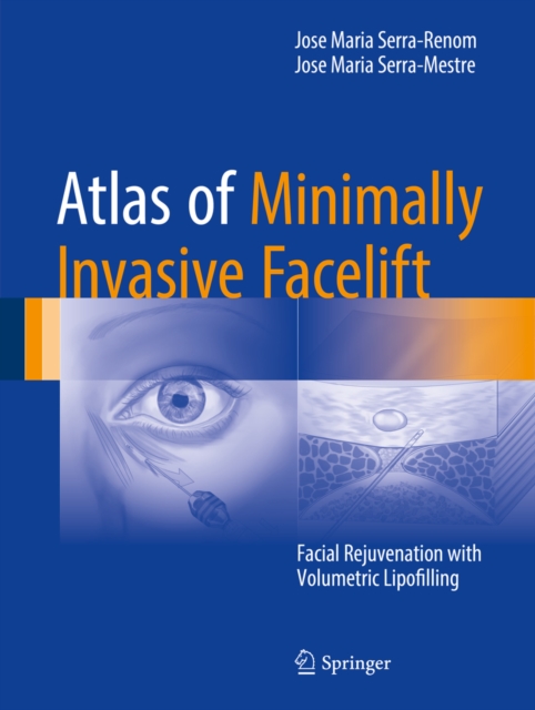 Atlas of Minimally Invasive Facelift : Facial Rejuvenation with Volumetric Lipofilling, PDF eBook