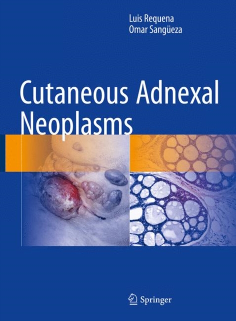 Cutaneous Adnexal Neoplasms, Hardback Book