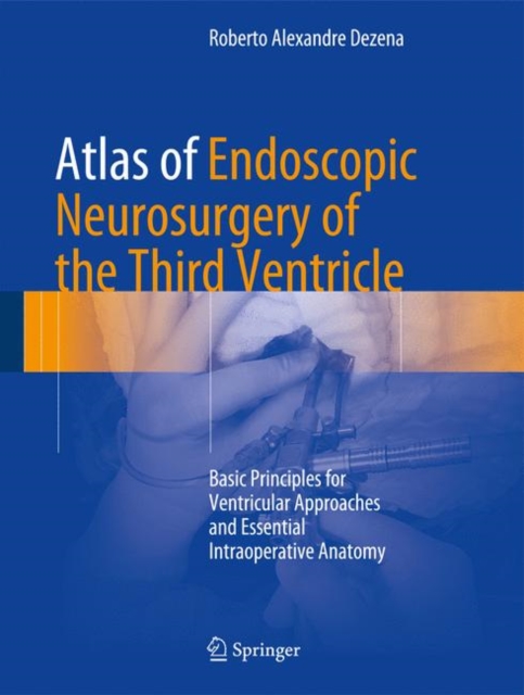 Atlas of Endoscopic Neurosurgery of the Third Ventricle : Basic Principles for Ventricular Approaches and Essential Intraoperative Anatomy, EPUB eBook